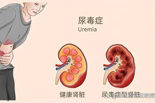 曼晚预测曼城vs哥本哈根首发：哈兰德、德布劳内、罗德里出战